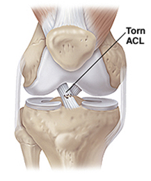 dog acl surgery cost