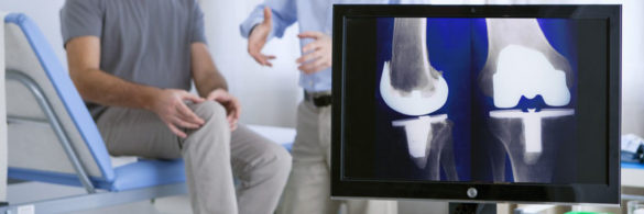 computer-navigated-joint-replacement-surgery