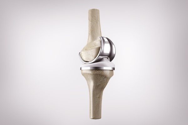 knee-replacement