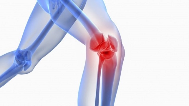 osteoarthritis-of-the-knee